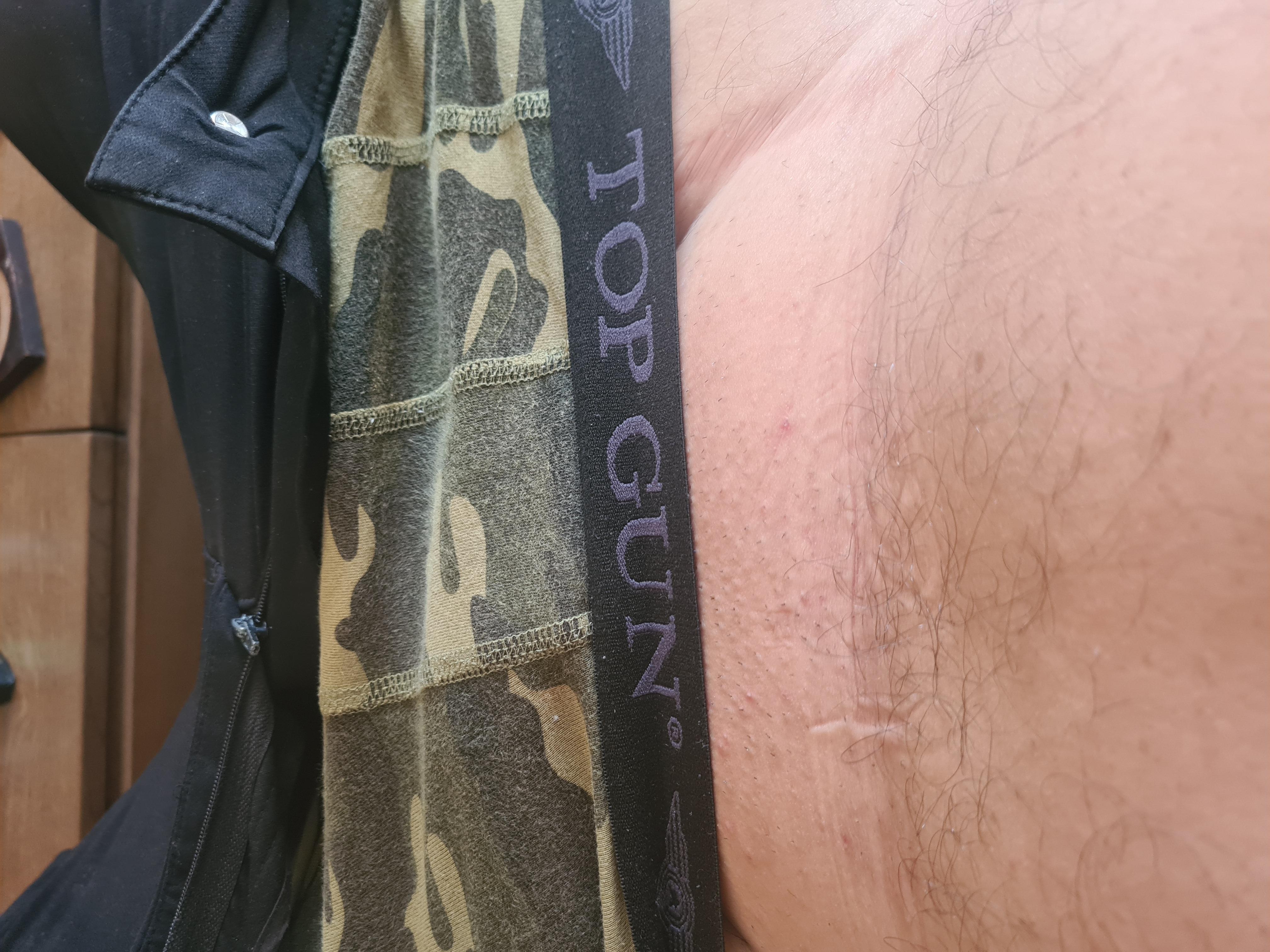 akismanhorny live from Greece